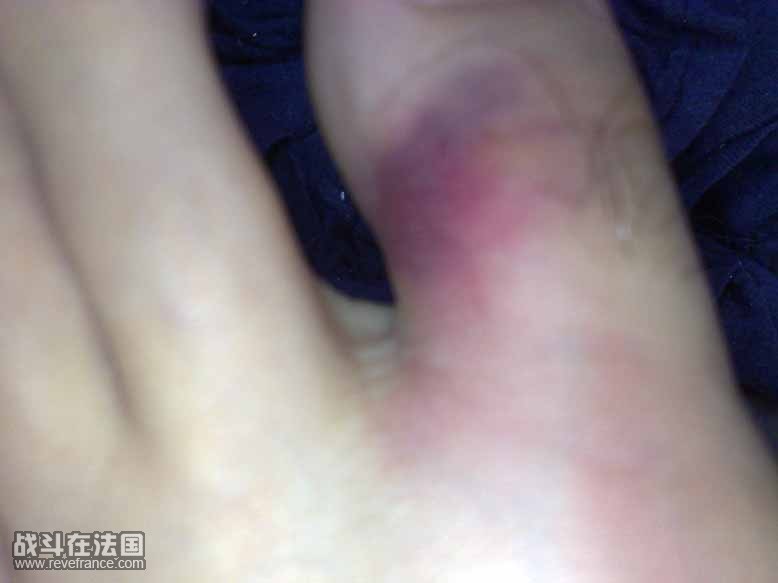 惨不忍睹1