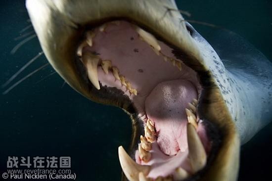 (Teeth exposure)/保罗-尼克伦(加拿大)