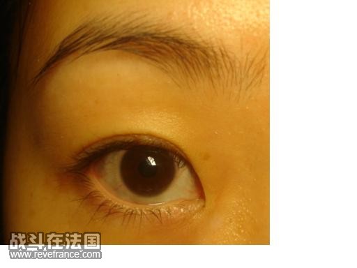 before.JPG