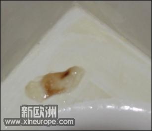 mucus2.jpg
