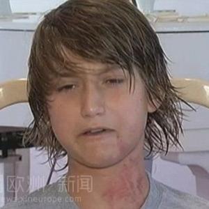 男孩坐过山车被飞鸽击中脸颊 鸽子暴毙血洒半空