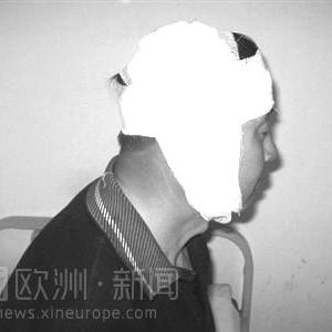 两村民为治痔疮偷食小雕 两年来遭金雕疯狂复仇